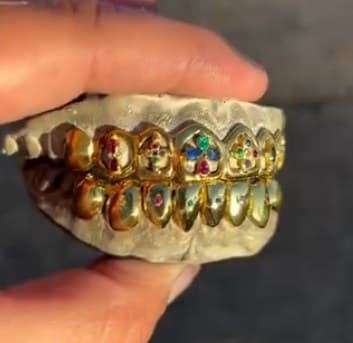 Gold gemstone grillz set